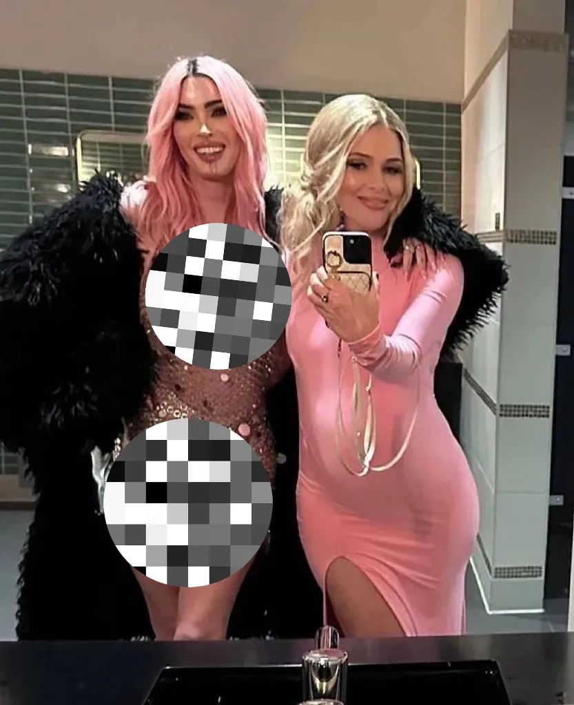 Understanding the Impact of Nose Structure on Eye Appearance in Rhinoplasty, image size:833x1024